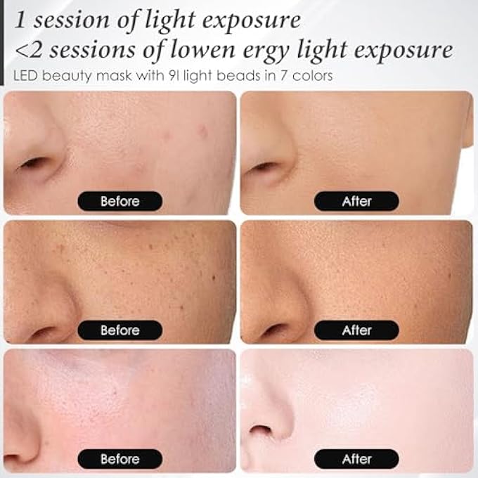 KASTWAVE RED LIGHT THERAPY FOR FACE, 7-1 COLORS LED FACIAL SKIN CARE MASK, RED LED FACE MASK LIGHT THERAPY AT HOME, LED FACE MASK LIGHT THERAPY, BLACK - Image 2